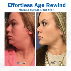 Nurbini® Sleeping V-Face Beauty Device