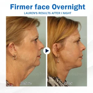 Nurbini® Sleeping V-Face Beauty Device