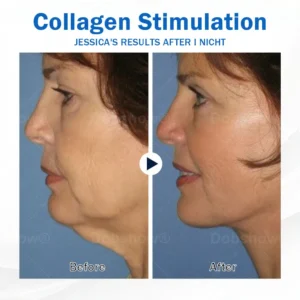 Nurbini® Sleeping V-Face Beauty Device