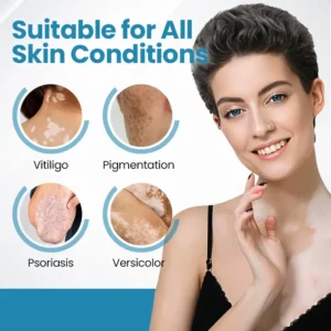 Nurbini®DermaBeam Vitiligo Therapy Device
